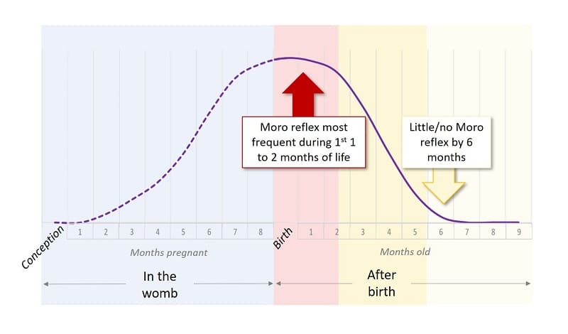 Moro reflex frequency by age chart