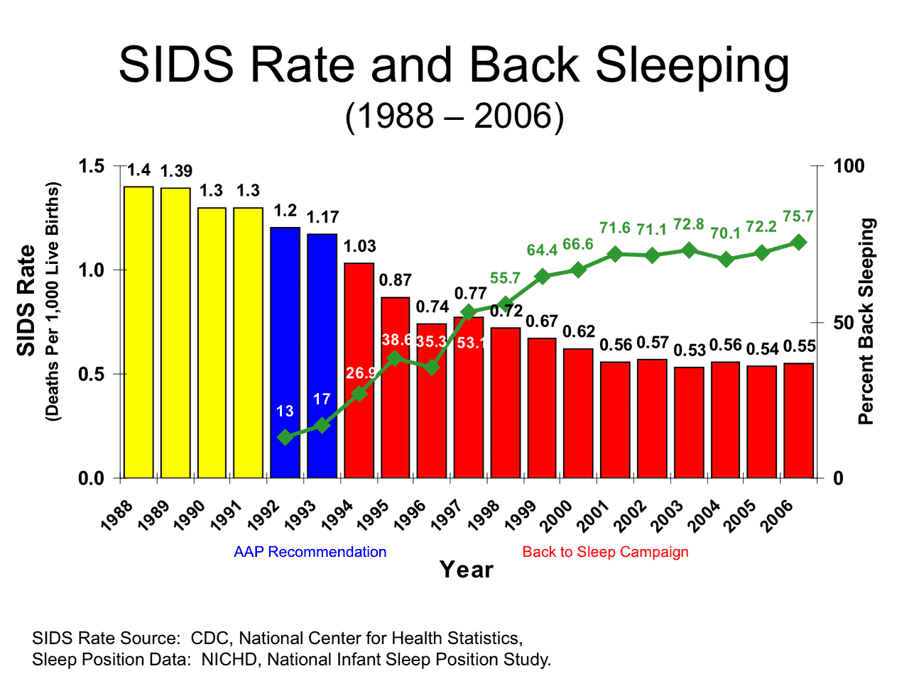 Incidence of SIDs in newborns following back to sleep campaign