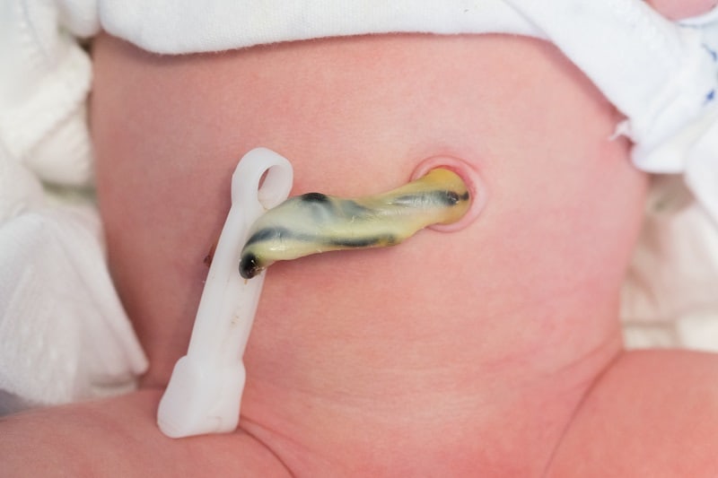 Don't tub bathe your newborn until umbilical cord has fallen off